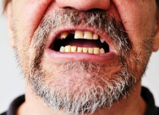 giải mã giấc mơ rụng răng