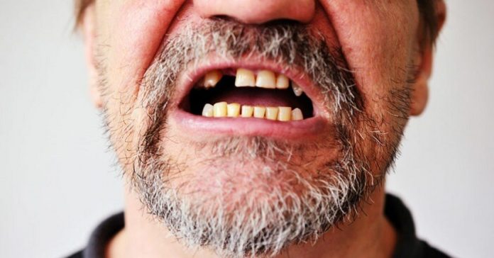 giải mã giấc mơ rụng răng